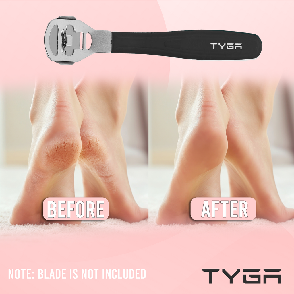 Callus Remover Foot Shaver, Hard Skin & Corn Removal – Blade not included