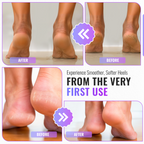 Foot File Rasp, Callus & Dry Skin Scrubber, 1 Pair