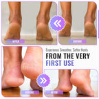 Foot File Rasp, Callus & Hard Skin Remover