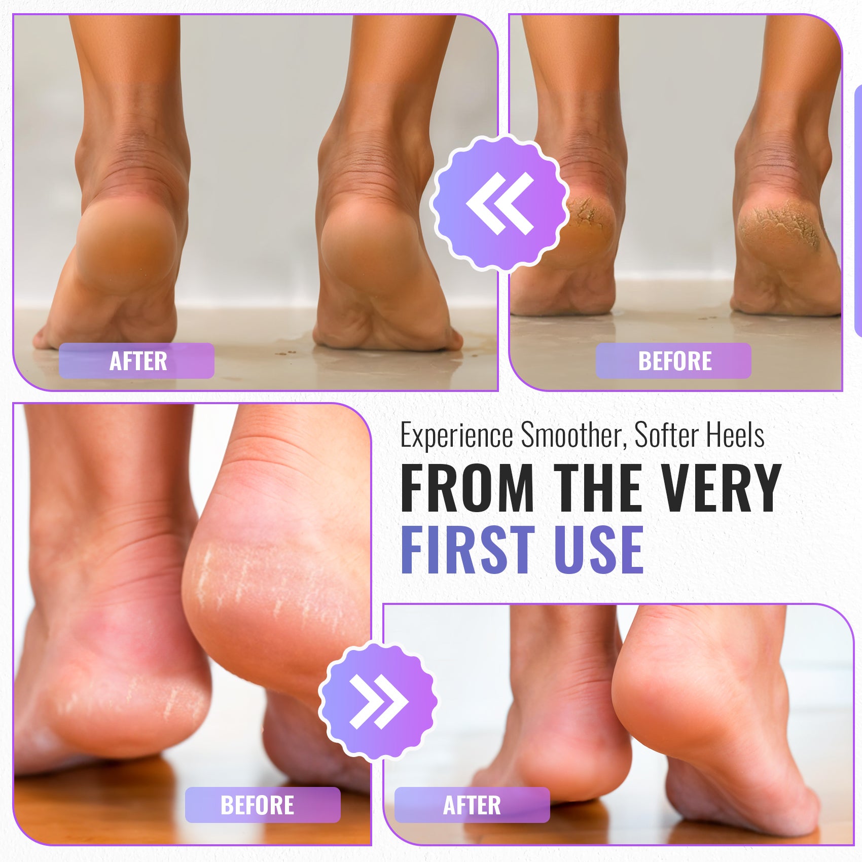 Foot File Rasp, Callus & Hard Skin Remover